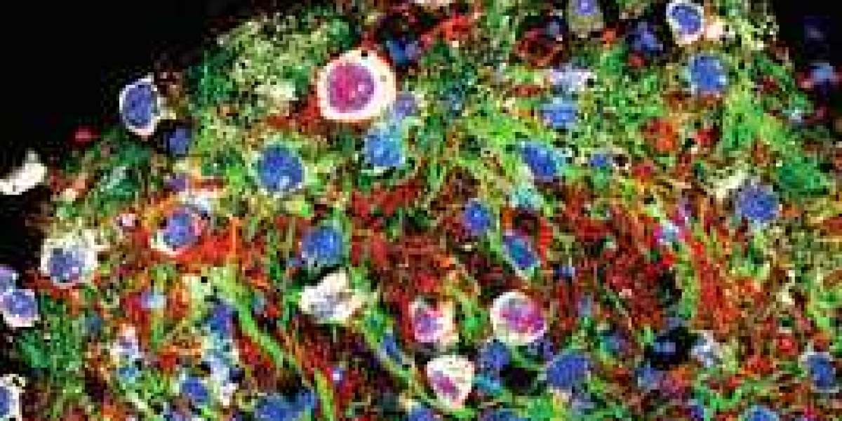 CD44s Gives Glioblastoma Brain Cancer a Survival Advantage