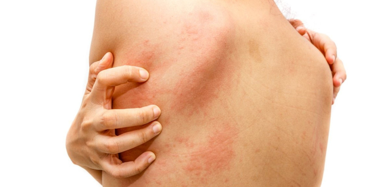 What is the best antibiotic to treat skin infections