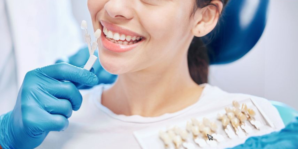 What Are Dental Veneers and How Can They Transform Your Smile?