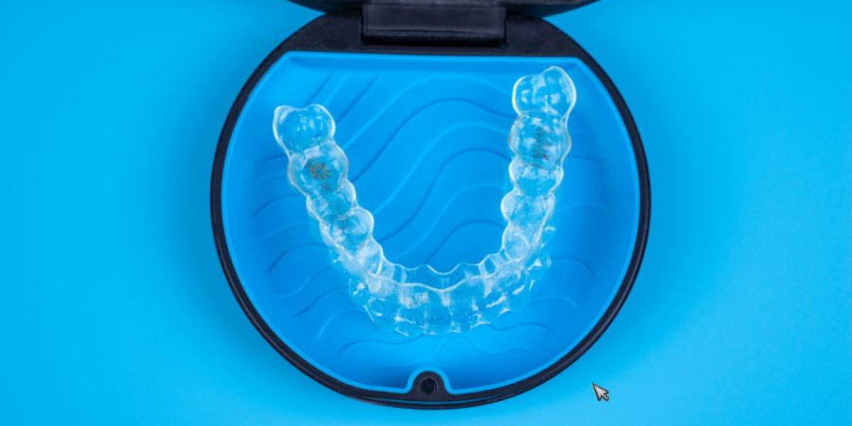 Top Benefits of Invisalign Treatment in London