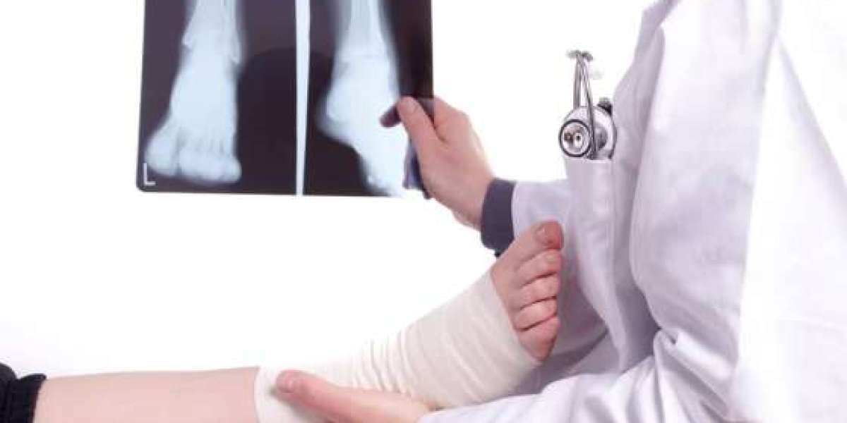 Advanced Ankle Fracture Treatment in Lahore at Ortho Center