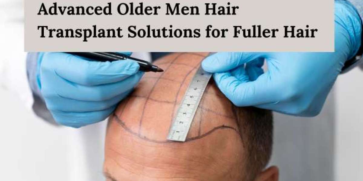 Advanced Older Men Hair Transplant Solutions for Fuller Hair