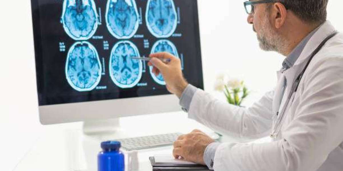 Find the Best Neurologists in Miranda: Trusted & Experienced Specialists