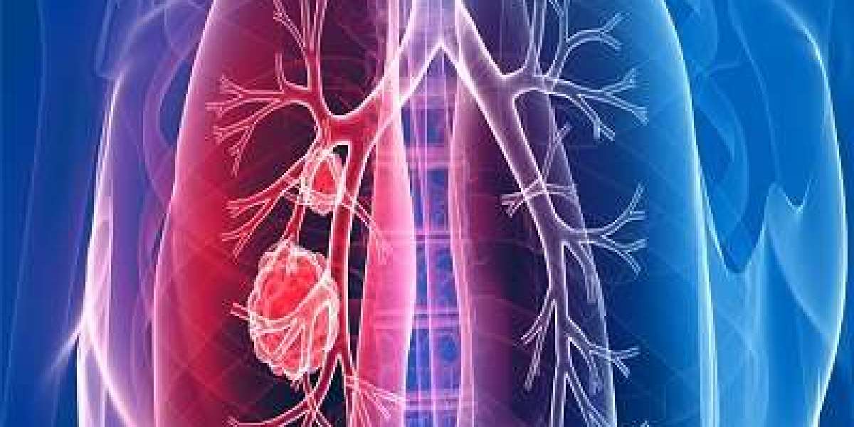 Global Lung Cancer Genomic Testing Market to 2032: Forecasts and Current Trends