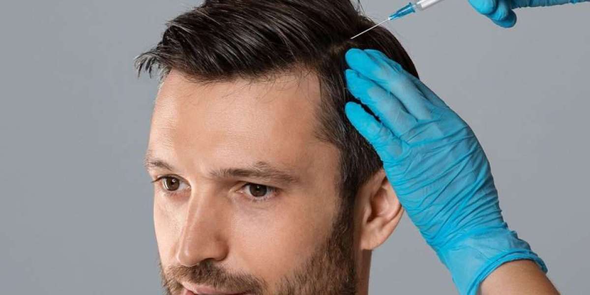 Is Your Hair Loss Getting Worse? Here’s How PRP, GFC & Affordable Hair Transplants in Delhi Can Help!