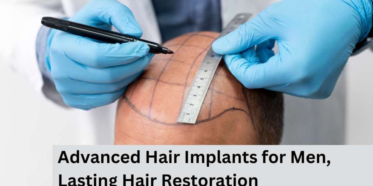 Advanced Hair Implants for Men, Lasting Hair Restoration