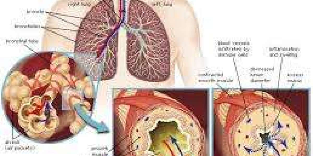 Managing Asthma & Allergies: Breathing & Nasal Relief