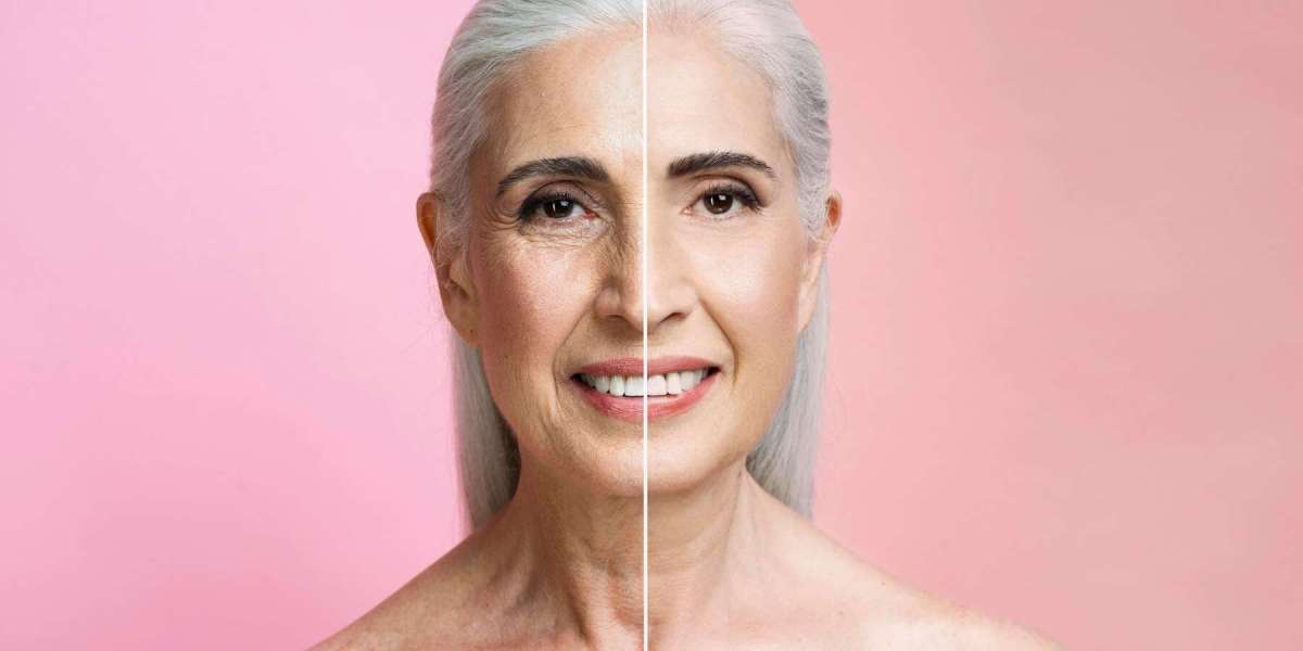 Jeuveau Before and After: What to Expect from This Popular Treatment