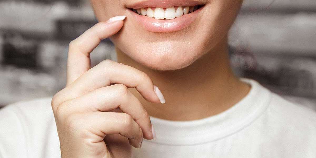 How Long Does Teeth Whitening Last? Tips to Maintain a Brighter Smile