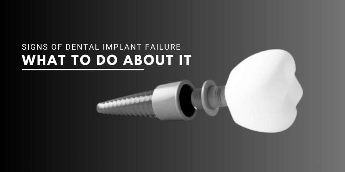 Signs of Dental Implant Failure and What to Do About It