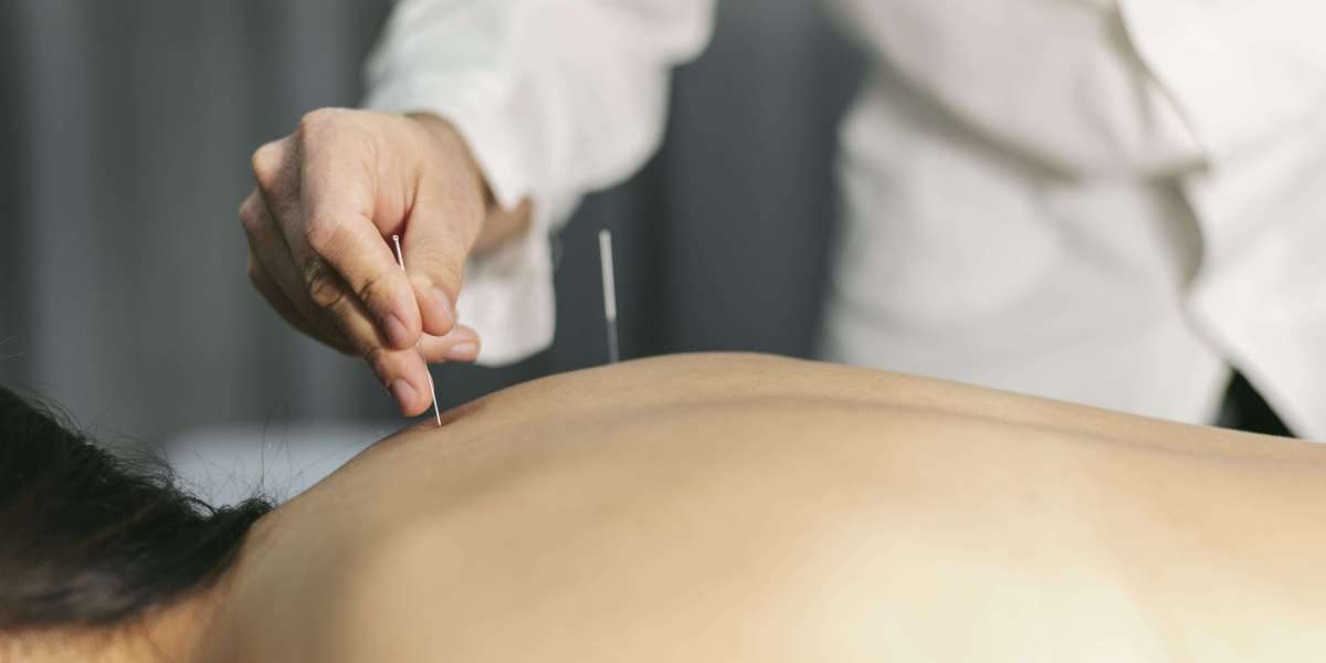 Acupuncture in Newport Beach at Hannah Integrative Health