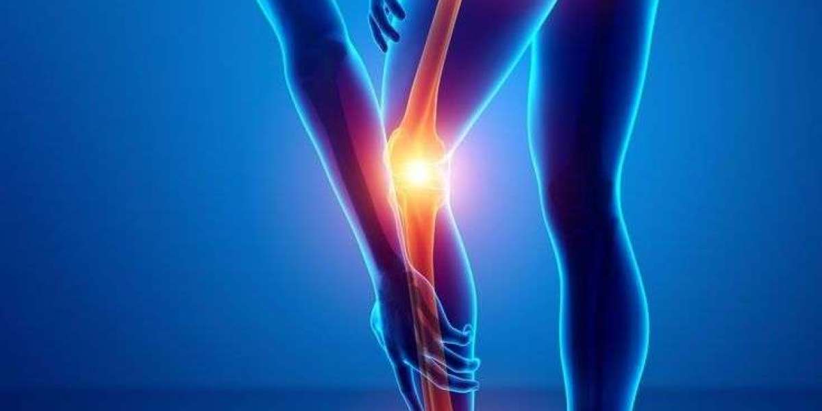 Understanding the Impact of Leg Pain