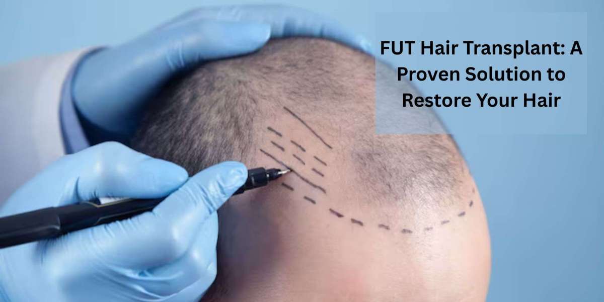 FUT Hair Transplant: A Proven Solution to Restore Your Hair