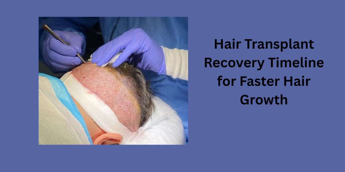 Hair Transplant Recovery Timeline for Faster Hair Growth