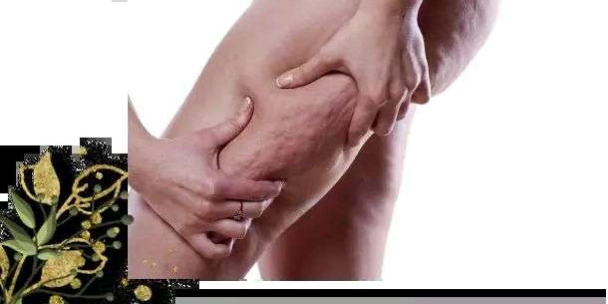 Say Goodbye to Stubborn Cellulite with Advanced Treatment in Delhi at Akaraby Aayna