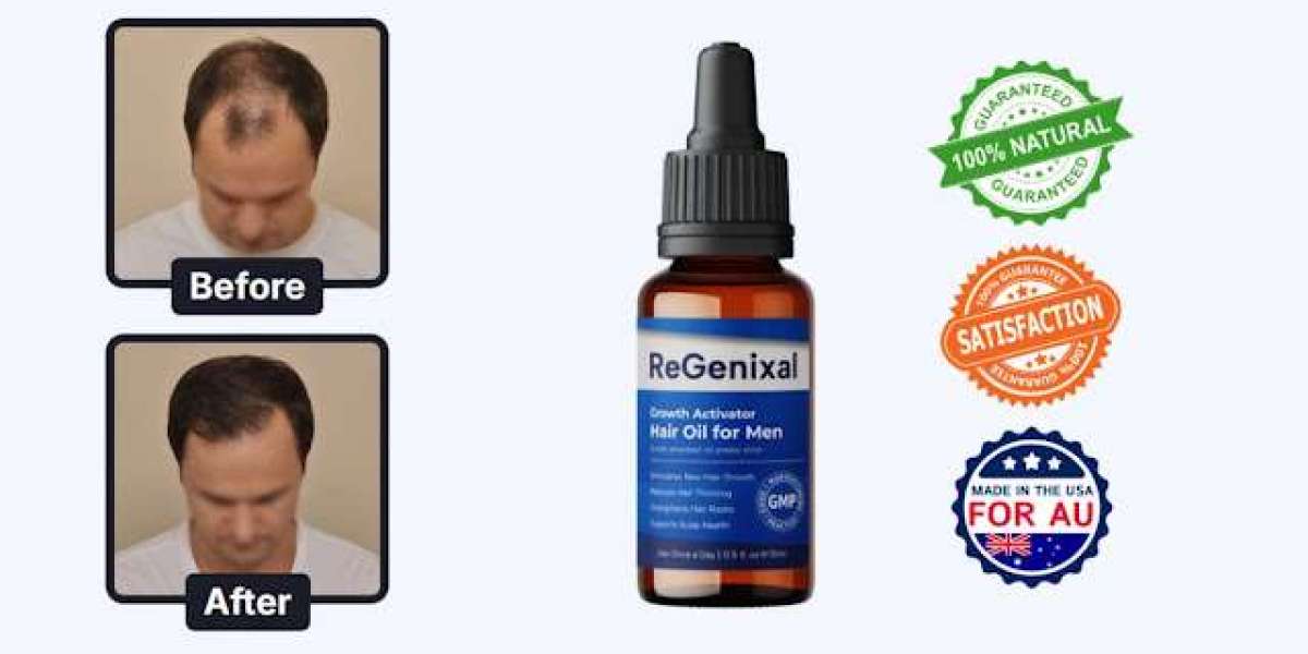 Can Regenixal stop hair thinning?