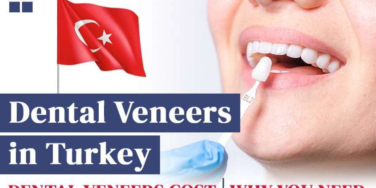 CureTurkey – A top destination for dental veneers in Turkey